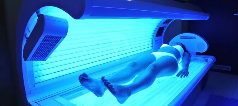 Krampfadern und Solarium